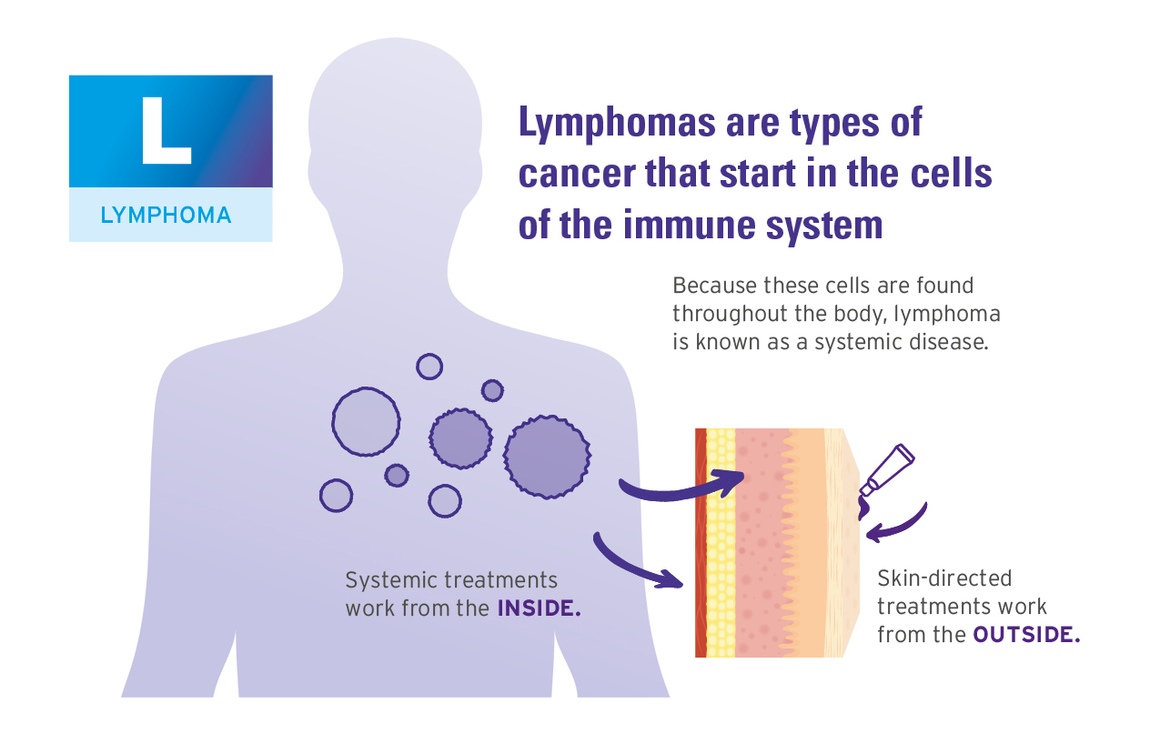 What Causes CTCL Skin Symptoms Website Images 3
